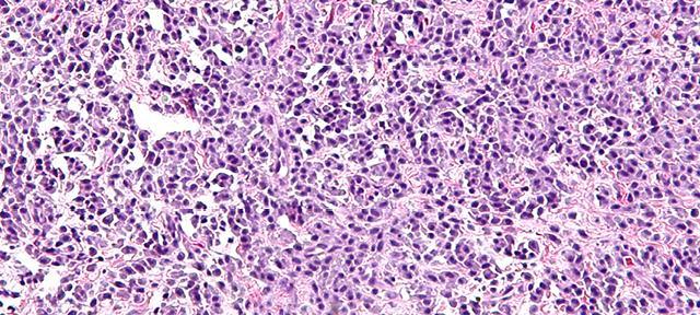mast cells mast cells